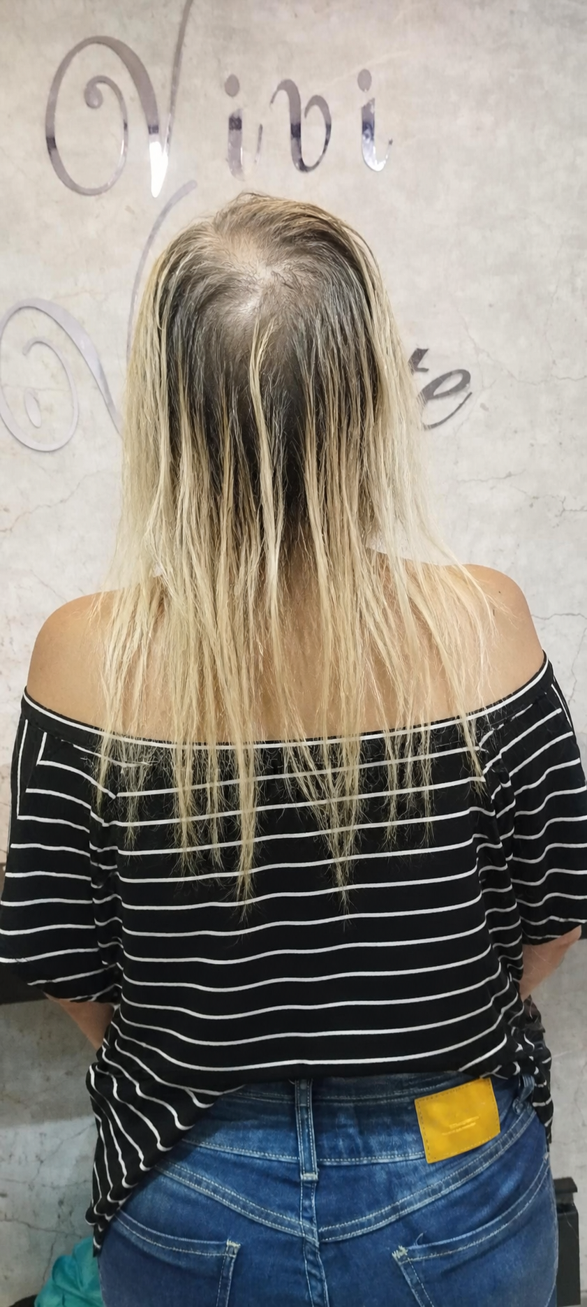 Antes: cabelo platinado com baixa densidade, falhas e pontas danificadas